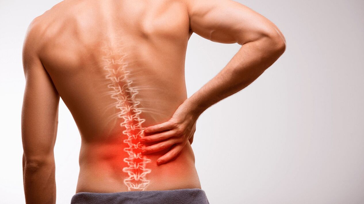 ciática lumbar
